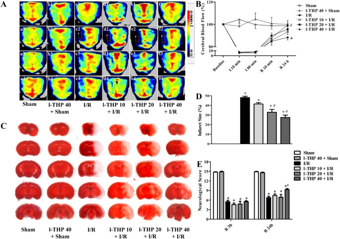 011-L Ttc Shiltron | Ttc